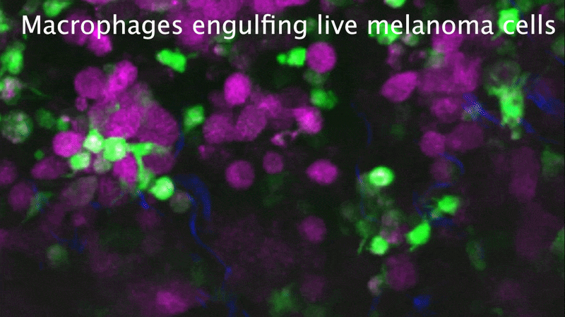Gif cycling through microscope video footage of green-stained macrophages engulfing purple cancer cells Gif cycling through microscope video footage of green-stained macrophages engulfing purple cancer cells